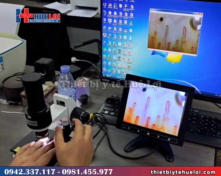 Kính hiển vi soi mạch máu độ phân giải cao
